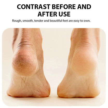 Rechargeable Electric Foot Grinder Dead Skin Remover Calluses Feet Scrubber Electric Foot File Dry Dead Cracked Foot Care Repair - The Urban Blasts Ltd